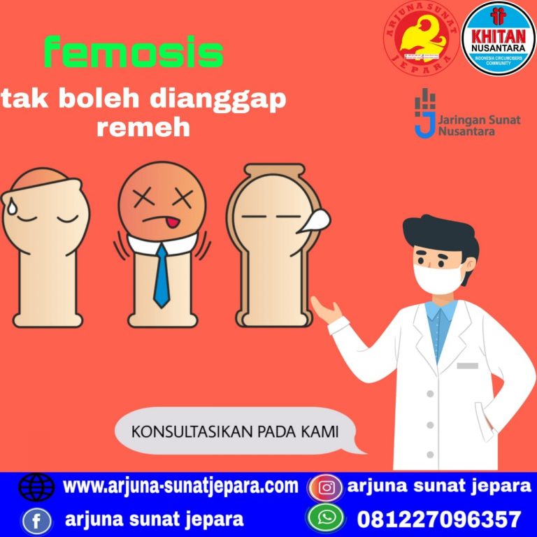 You are currently viewing FIMOSIS BY ARJUNA SUNAT JEPARA 081.227.096.357